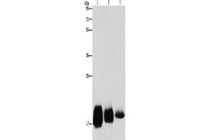 Western Blotting (WB) image for anti-CD59 (CD59) antibody (ABIN5546549) (CD59 antibody)