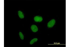 Immunofluorescence of purified MaxPab antibody to ZNF319 on HeLa cell. (ZNF319 antibody  (AA 1-582))