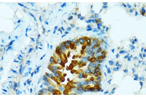 CYP2B6 antibody