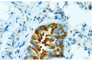 Immunohistochemistry of paraffin-embedded Mouse lung using CYP2B6 Polyclonal Antibody at dilution of 1:100 (40x lens). (CYP2B6 antibody)