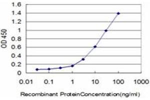 Detection limit for recombinant GST tagged ERN1 is approximately 0. (ERN1 antibody  (AA 401-500))