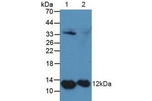 Figure. (s100a4 antibody  (AA 2-101))