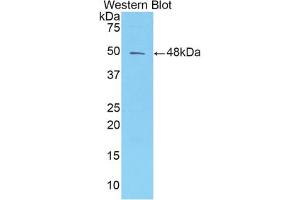 Western blot analysis of the recombinant protein. (AMBP antibody  (AA 20-202))