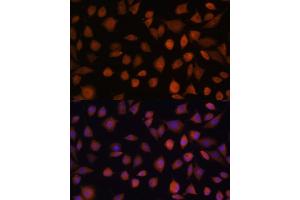 Immunofluorescence analysis of L929 cells using  antibody (ABIN7265674) at dilution of 1:100. (ARMC6 antibody  (AA 1-220))