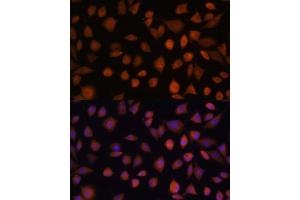 Immunofluorescence analysis of L929 cells using  antibody (ABIN7265674) at dilution of 1:100. (ARMC6 antibody  (AA 1-220))