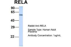 Host: Rabbit  Target Name: RELA  Sample Tissue: Human Adult Placenta  Antibody Dilution: 1. (NF-kB p65 antibody  (Middle Region))