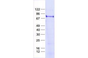 Validation with Western Blot (ZSCAN12 Protein (His tag))