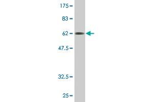 Western Blot detection against Immunogen (61. (FCER2 antibody  (AA 1-321))