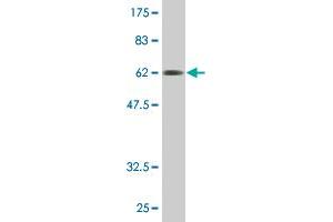 Western Blot detection against Immunogen (61. (FCER2 antibody  (AA 1-321))