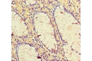 Immunohistochemistry (IHC) image for anti-CD34 (CD34) (AA 124-375) antibody (ABIN7154947)