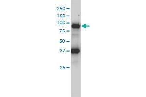 FES monoclonal antibody (M01), clone 3A3-1E5 Western Blot analysis of FES expression in HL-60 . (FES antibody  (AA 1-822))
