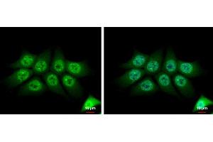 ICC/IF Image TMS1 antibody [N1C3] detects TMS1 protein at cytoplasm and nucleus by immunofluorescent analysis. (PYCARD antibody)