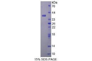 SDS-PAGE analysis of Mouse ALDH1A1 Protein.