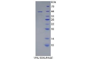 SDS-PAGE (SDS) image for CD19 Molecule (CD19) (AA 160-258) protein (His tag,GST tag) (ABIN1879536) (CD19 Protein (AA 160-258) (His tag,GST tag))
