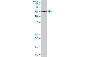 ME1 monoclonal antibody (M03), clone 3H5. (ME1 antibody  (AA 1-572))