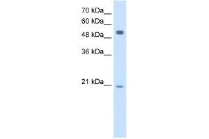 WB Suggested Anti-BLK Antibody Titration:  2. (BLK antibody  (Middle Region))