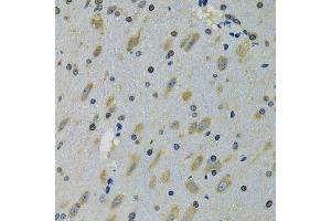 Immunohistochemistry of paraffin-embedded mouse brain using RPS12 antibody. (RPS12 antibody  (AA 1-132))