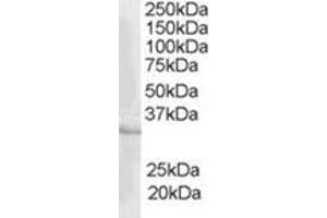 Image no. 1 for anti-CAMP Responsive Element Modulator (CREM) (C-Term) antibody (ABIN374482) (CREM antibody  (C-Term))
