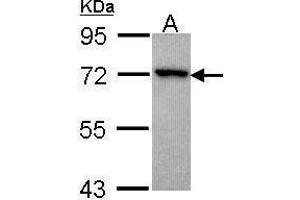 WB Image Sample (30 ug of whole cell lysate) A: Hela 7. (ADRBK2 antibody  (N-Term))