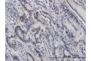 Immunohistochemistry (IHC) image for anti-Tumor Protein P53 (TP53) (pSer315) antibody (ABIN3201006) (p53 antibody  (pSer315))