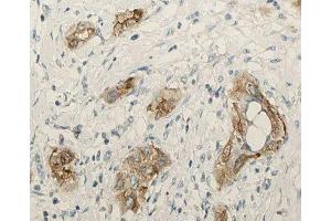 ABIN6276910 at 1/100 staining human lung tissue sections by IHC-P. (Surfactant Protein C antibody  (N-Term))