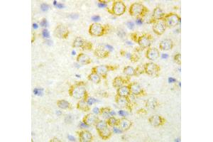 Anti-FGF9 antibody, IHC(P) IHC(P): Rat Brain Tissue (FGF9 antibody  (Middle Region))