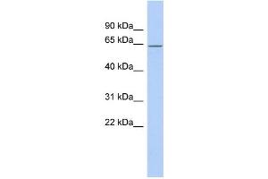 WB Suggested Anti-RNPC3 Antibody Titration:  0.