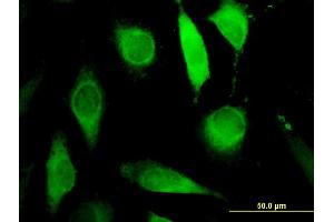 Immunofluorescence of monoclonal antibody to AGPAT6 on HeLa cell. (AGPAT6 antibody  (AA 39-137))