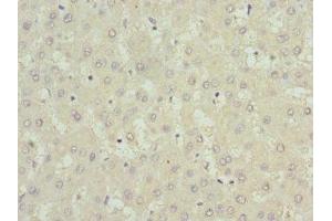 Immunohistochemistry of paraffin-embedded human liver tissue using ABIN7174262 at dilution of 1:100 (USP15 antibody  (C-Term))