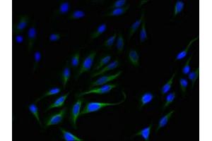 Immunofluorescent analysis of Hela cells using ABIN7170235 at dilution of 1:100 and Alexa Fluor 488-congugated AffiniPure Goat Anti-Rabbit IgG(H+L) (SLC35F5 antibody  (AA 122-242))