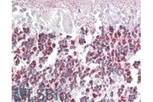 Image no. 2 for anti-Epilepsy, Progressive Myoclonus Type 2A, Lafora Disease (Laforin) (EPM2A) (Internal Region), (Isoform A) antibody (ABIN375087) (EPM2A antibody  (Internal Region, Isoform A))