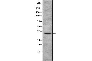 Western blot analysis OR4A47 using HeLa whole cell lysates (OR4A47 antibody  (Internal Region))