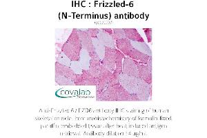 Image no. 1 for anti-Frizzled Family Receptor 6 (FZD6) (Extracellular Domain), (N-Term) antibody (ABIN1734469) (FZD6 antibody  (Extracellular Domain, N-Term))