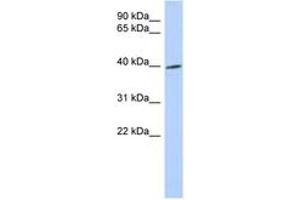 Image no. 1 for anti-Tribbles Homolog 1 (TRIB1) (AA 215-264) antibody (ABIN6743637) (TRIB1 antibody  (AA 215-264))