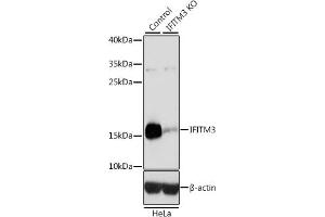 Western blot analysis of extracts from normal (control) and IFITM3 knockout (KO) HeLa cells, using IFITM3 antibody (ABIN6130482, ABIN6142186, ABIN6142187 and ABIN7101416) at 1:3000 dilution. (IFITM3 antibody  (AA 1-133))