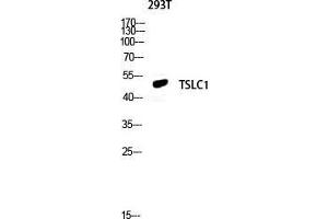 Western Blot (WB) analysis of 293T lysis using TSLC1 antibody.