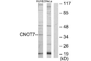 Western blot analysis of extracts from HUVEC cells and HeLa cells, using CNOT7 antibody.