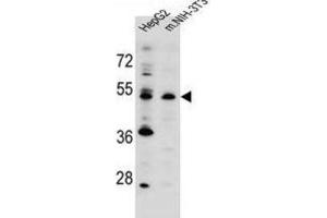 Western Blotting (WB) image for anti-Potassium Channel Modulatory Factor 1 (KCMF1) antibody (ABIN2996241)