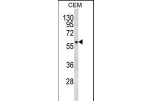 Western blot analysis of FLCN Antibody (Center) (ABIN652602 and ABIN2842404) in CEM cell line lysates (35 μg/lane). (FLCN antibody  (AA 325-354))
