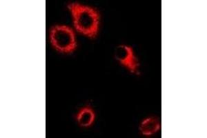 Immunofluorescent analysis of SerRS staining in MCF7 cells. (Seryl-tRNA Synthetase (SARS) antibody)