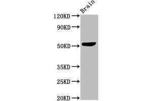Western Blot Positive WB detected in: Mouse brain tissue All lanes: SLC30A10 antibody at 3 μg/mL Secondary Goat polyclonal to rabbit IgG at 1/50000 dilution Predicted band size: 53, 27, 25 kDa Observed band size: 53 kDa (SLC3A1 antibody  (AA 58-278))