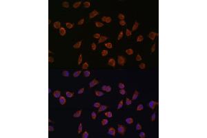Immunofluorescence analysis of L929 cells using  antibody (ABIN7265426) at dilution of 1:100. (ACSS1 antibody  (AA 340-689))