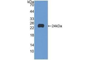 Detection of Recombinant SCFR, Human using Polyclonal Antibody to Stem Cell Factor Receptor (SCFR) (KIT antibody  (AA 321-520))