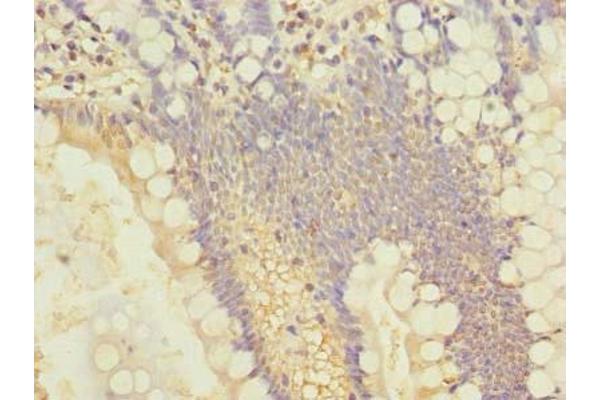 SLC25A4 antibody  (AA 40-74)