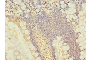 Immunohistochemistry of paraffin-embedded human small intestine tissue using ABIN7143534 at dilution of 1:100 (SLC25A4 antibody  (AA 40-74))