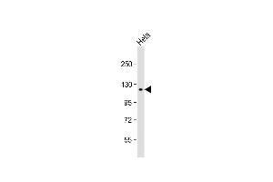 Anti-SNX13 Antibody (C-term) at 1:1000 dilution + Hela whole cell lysate Lysates/proteins at 20 μg per lane.