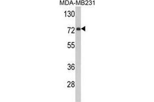 Western blot analysis of FMO3 Antibody (N-term) in MDA-MB231 cell line lysates (35 µg/lane).