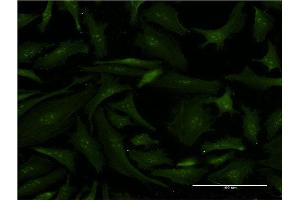 Immunofluorescence of monoclonal antibody to ERCC2 on HeLa cell. (ERCC2 antibody  (AA 631-730))