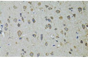 Immunohistochemistry of paraffin-embedded Rat brain using UGDH Polyclonal Antibody at dilution of 1:100 (40x lens). (UGDH antibody)