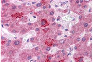 Human Liver: Formalin-Fixed, Paraffin-Embedded (FFPE) (HGF antibody  (AA 216-265))